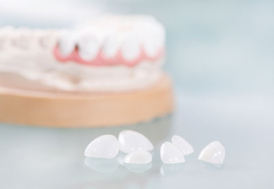 Visit Our Cosmetic Dentistry Office For Dental Crowns