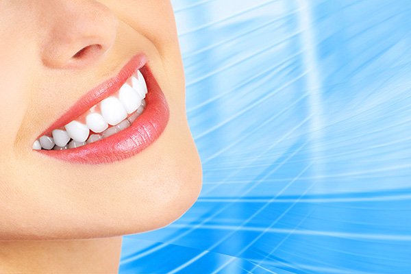 FAQs About Teeth Whitening